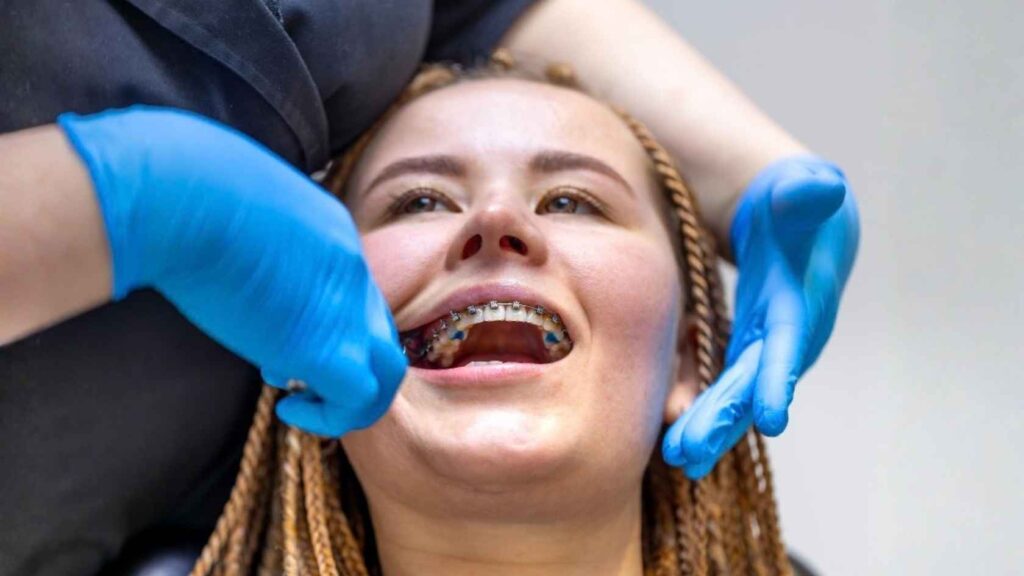 braces treatment cost
