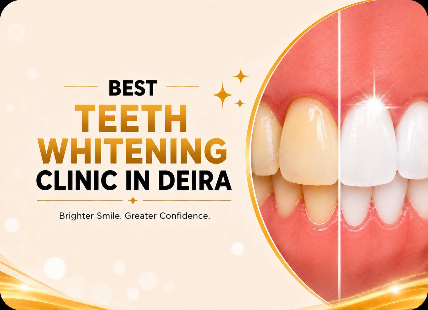 Best teeth whitening clinic in Deira with before and after teeth whitening smile comparison