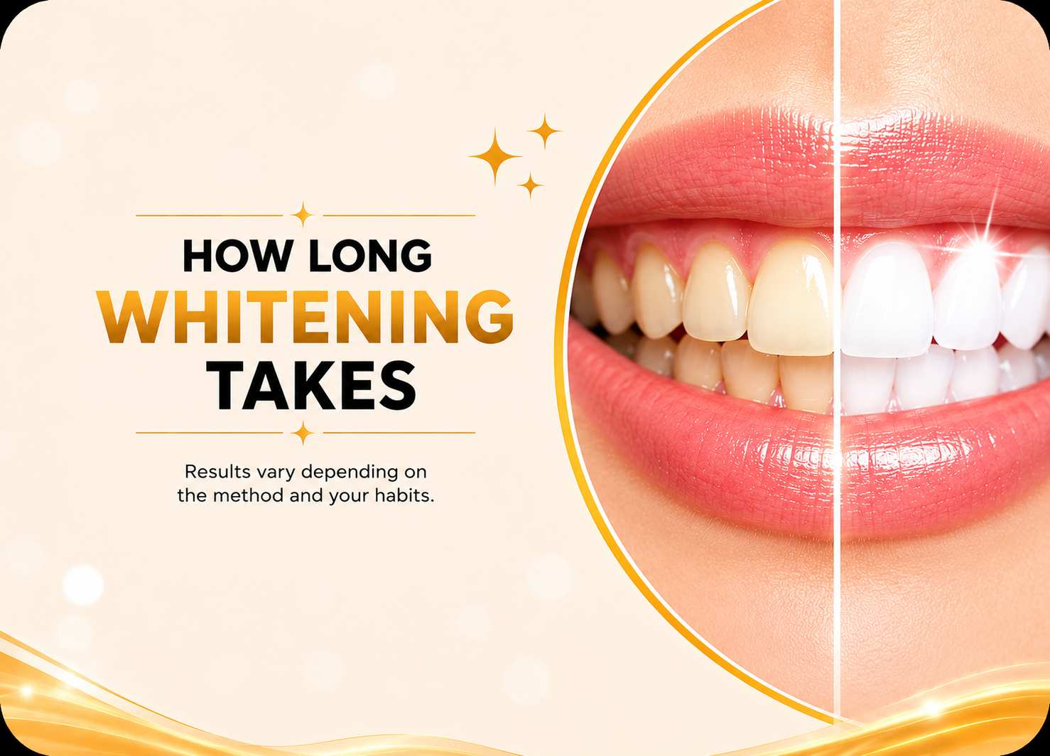 Illustration showing how long whitening takes with before and after teeth whitening comparison and bright smile design