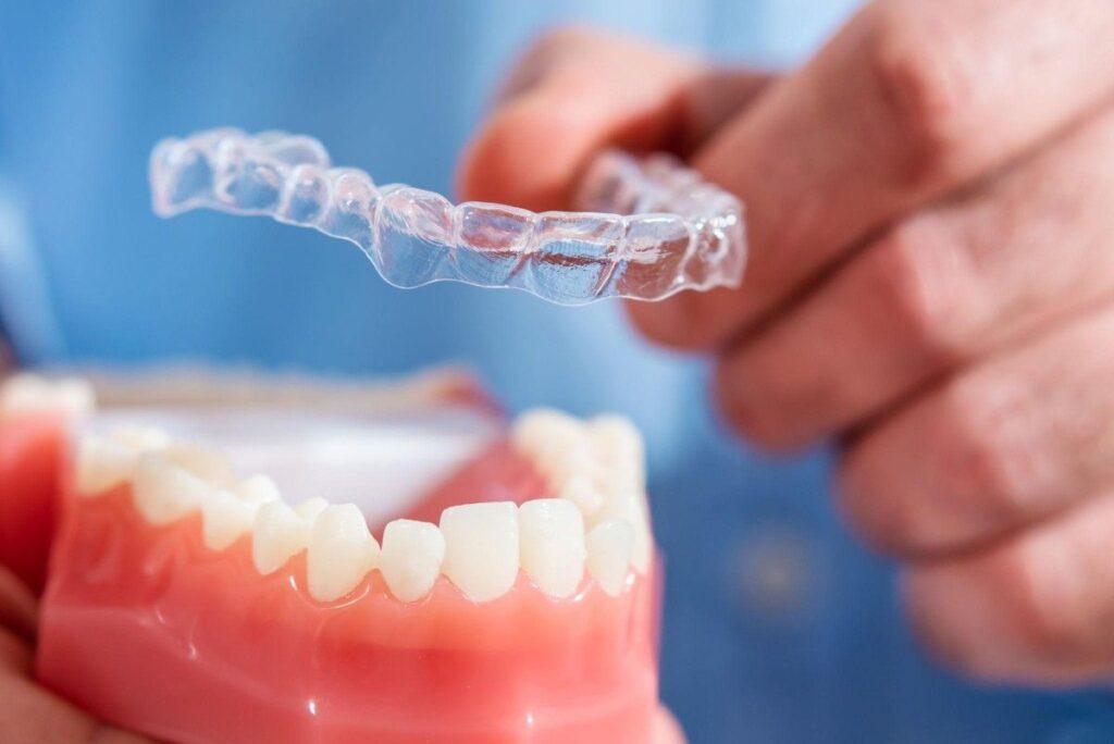 Cost of Invisible Aligners in Deira – patient holding a transparent clear aligner before orthodontic treatment
