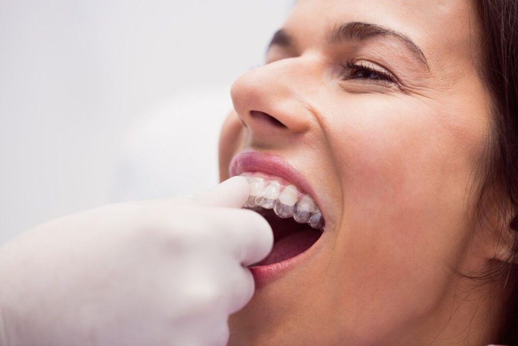 Benefits of Invisible Aligners demonstrated during treatment as a patient comfortably wears clear aligner trays for discreet teeth straightening