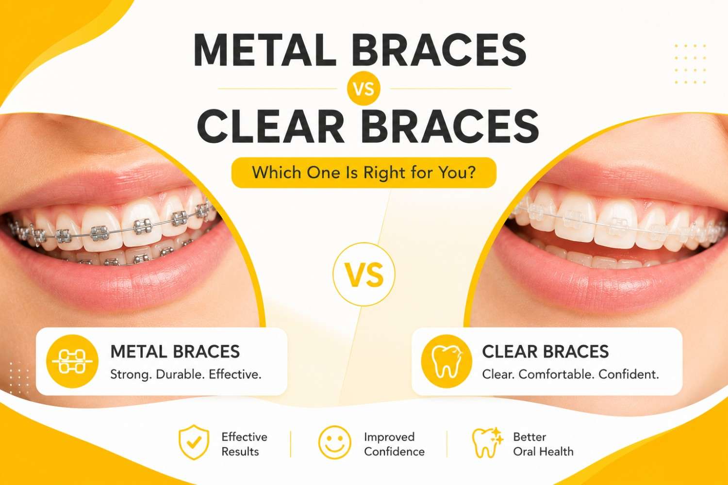 Featured image comparing metal braces and clear braces, showing the appearance of both orthodontic treatment options on a clean yellow and white background.