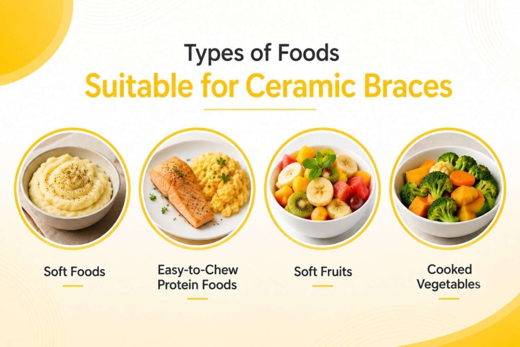 Infographic showing four types of foods suitable for people with ceramic braces: soft foods, easy-to-chew protein foods, soft fruits, and cooked vegetables, using realistic food images in a yellow and white design.