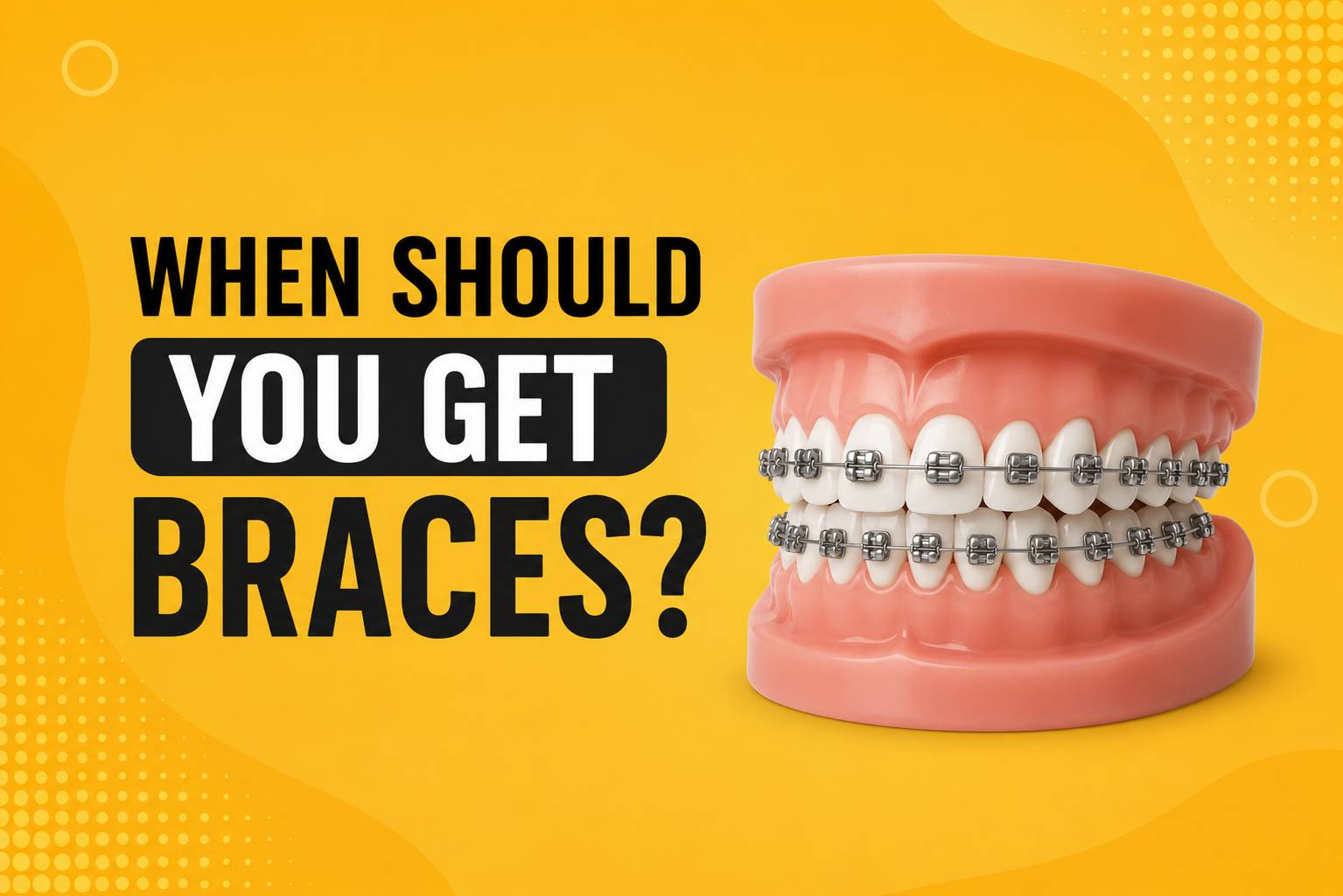 Illustration of dental braces with the text "When Should You Get Braces?" on a yellow background.