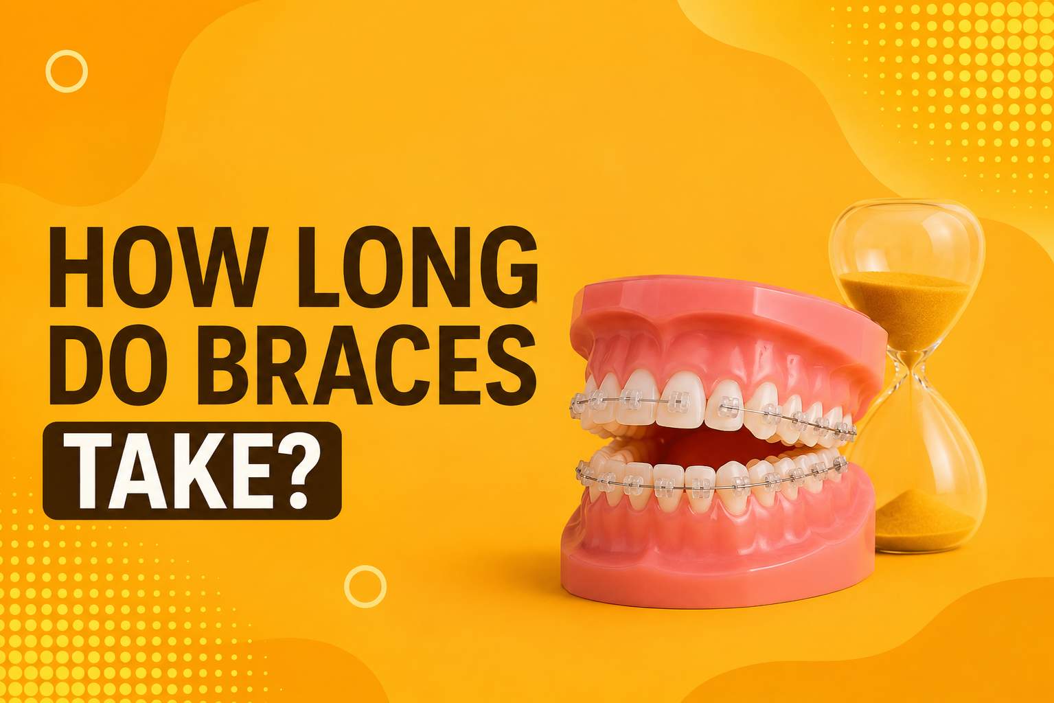 How Long Do Braces Take illustration showing ceramic braces with an hourglass representing orthodontic treatment duration.