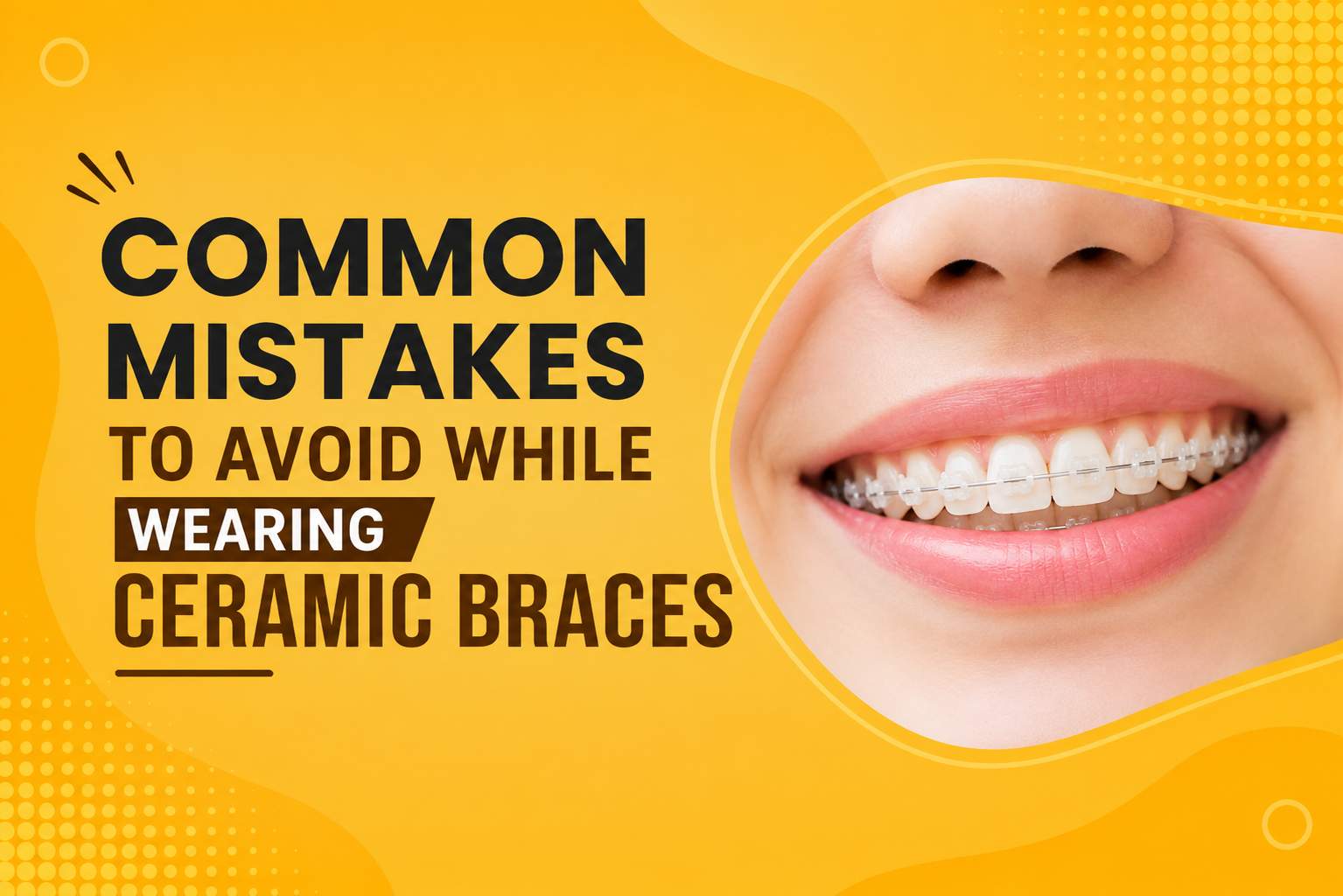 Smiling person wearing ceramic braces with the title Common Mistakes to Avoid While Wearing Ceramic Braces on a yellow background.