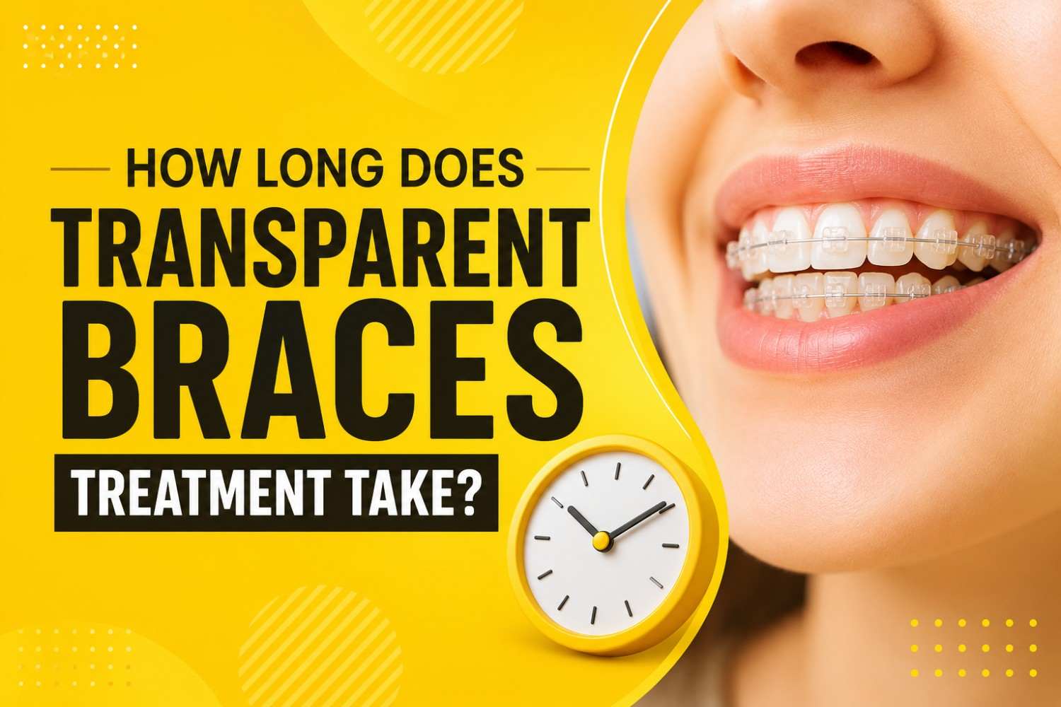 How Long Does Transparent Braces Treatment Take?
